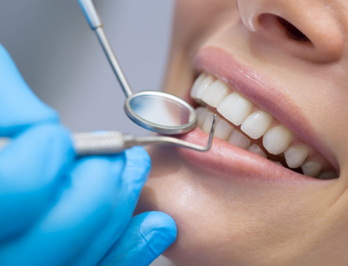 How to take care of your dental implants after surgery?
